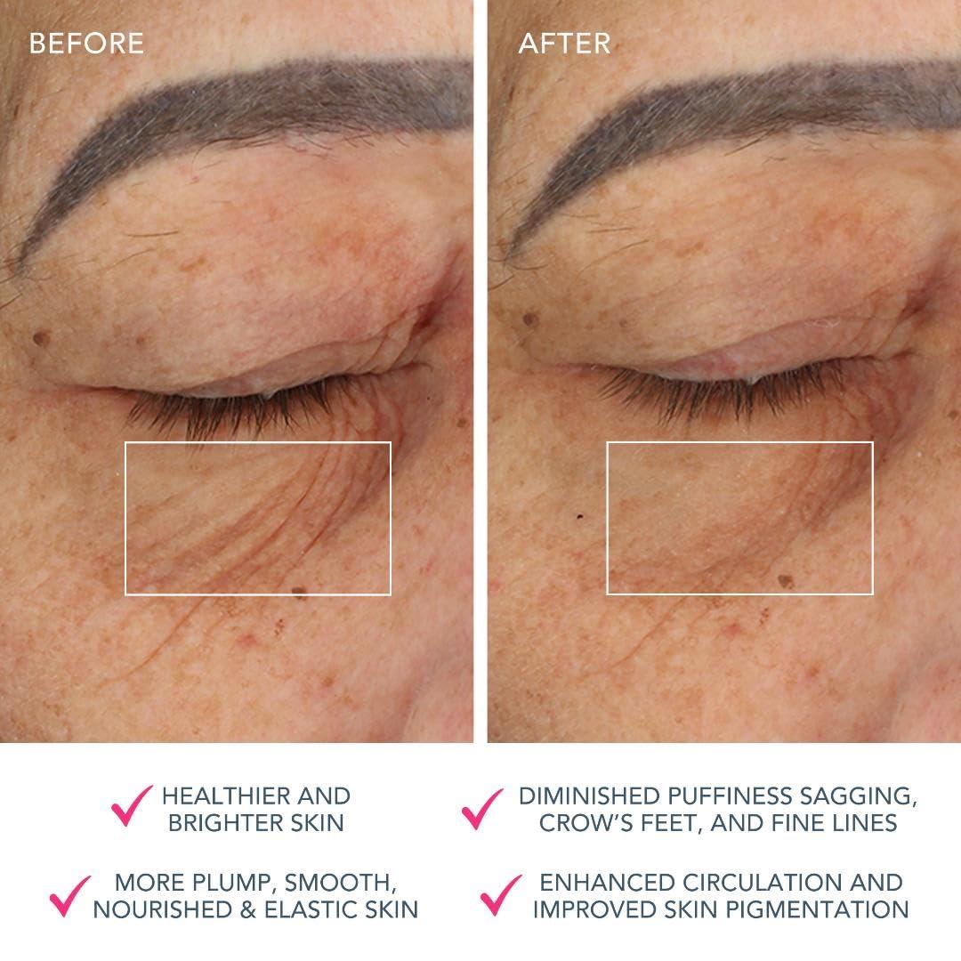 imageFOREO AgeDefying Bear Bundle Bear Microcurrent Facial Device 2 x Conductive Serum 1 floz Anti Aging Face Massager Skin Care Tools Set for an Instant Face Lift FuchsiaFuchsia