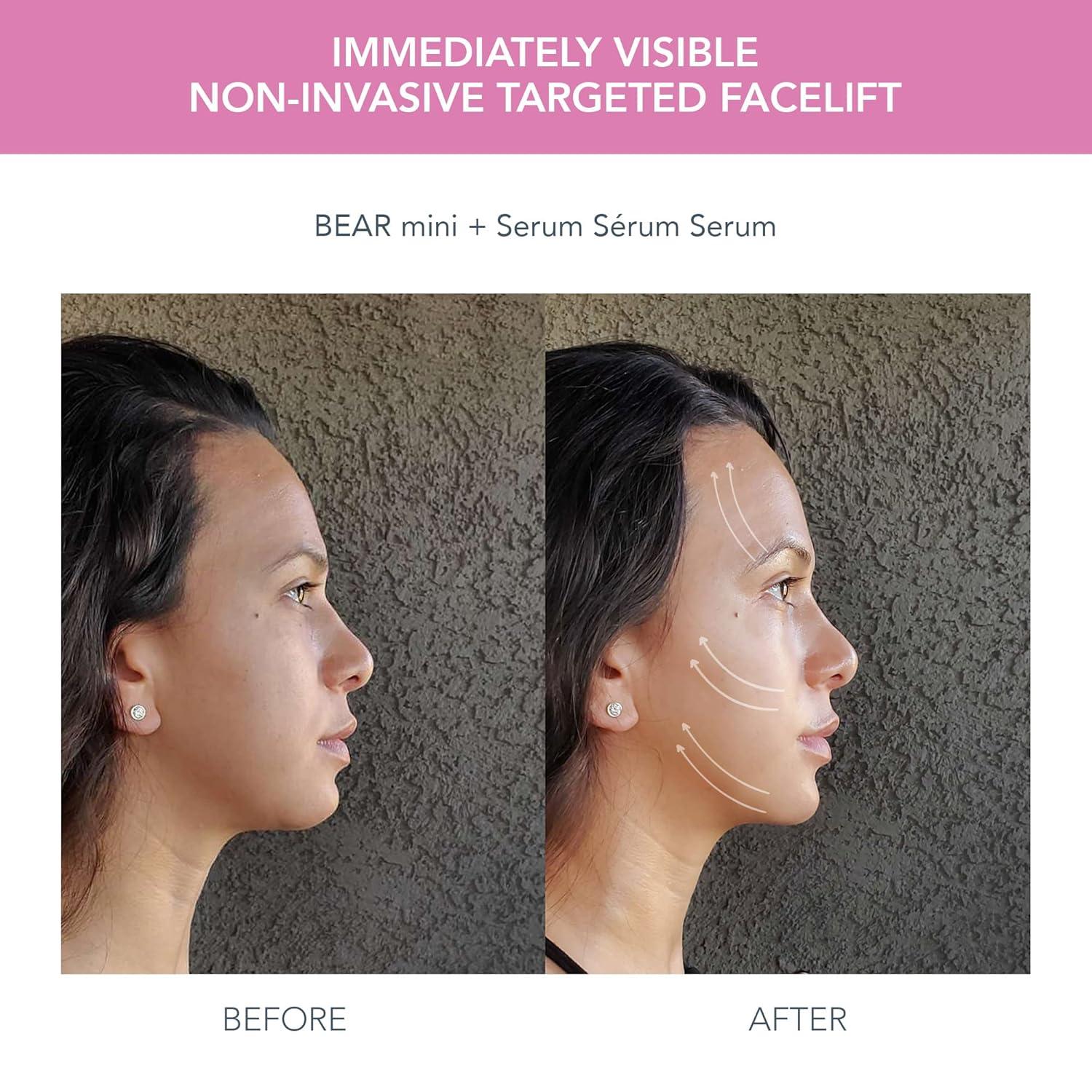 imageFOREO BEAR mini Microcurrent Facial Device UFO mini 2 Face Mask Treatment SERUM 1 fl oz 6 UFO Power Activated Masks Skin Supremes Holiday SetBEAR mini UFO mini 2 UFO masks