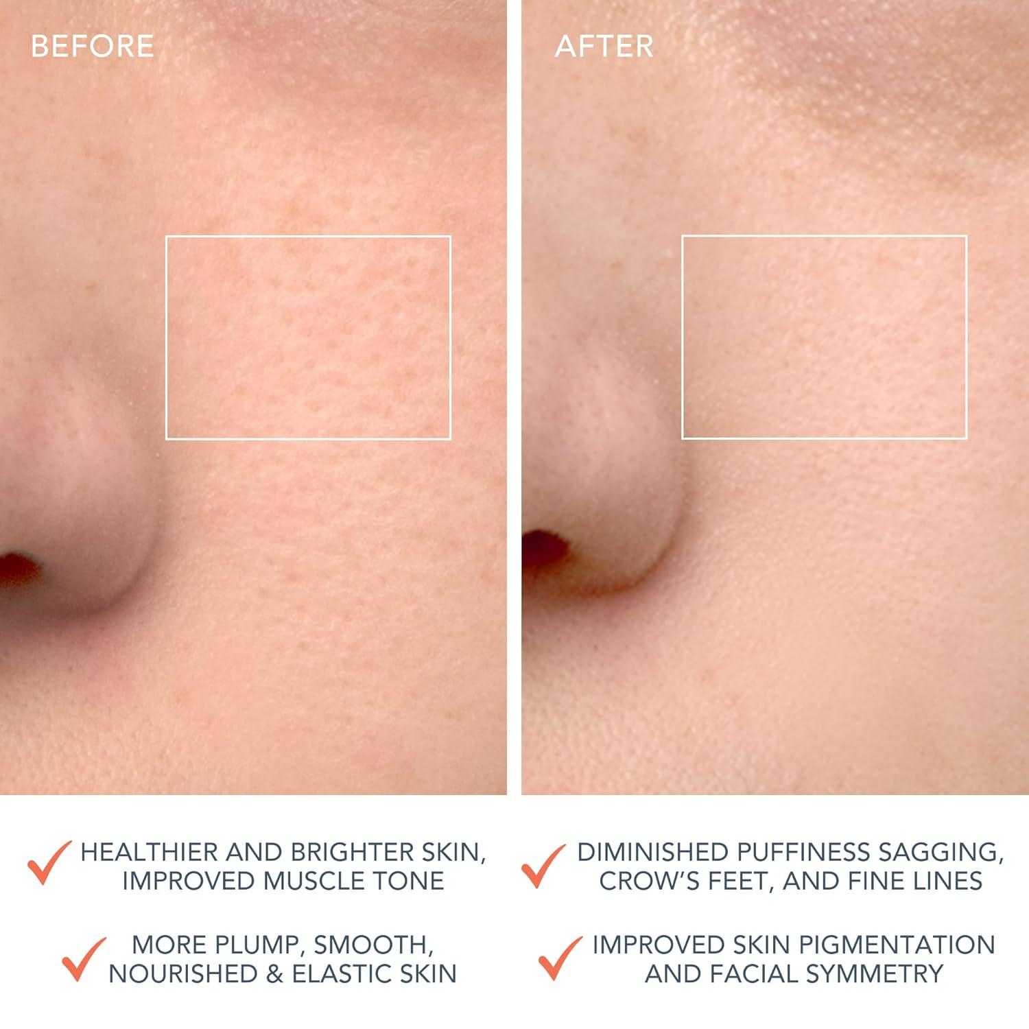 imageFOREO LUNA 4 Face Cleansing Brush Anti Aging Enhances Absorption of Facial Skin Care Products Simple Skin Care Tools Balanced SkinBalanced Skin