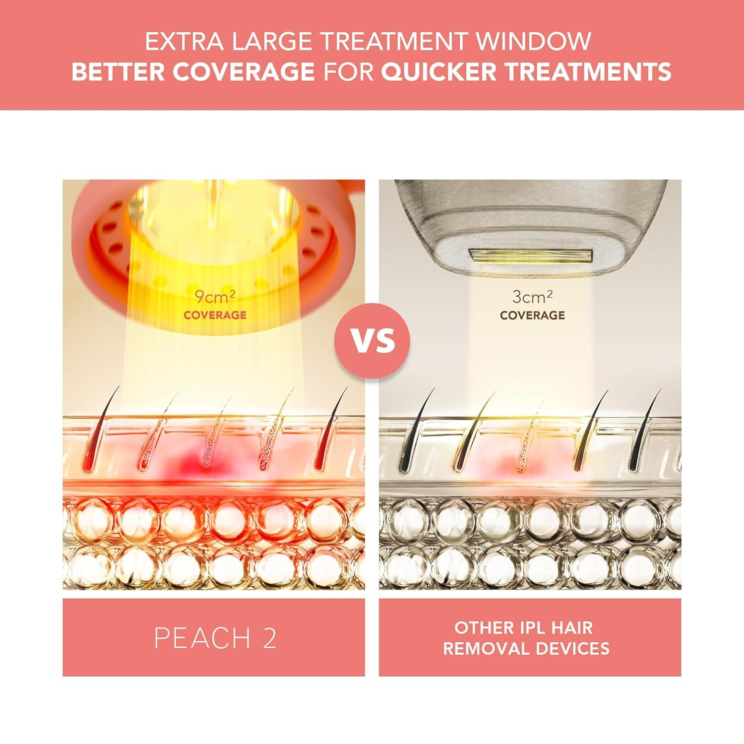 imageFOREO Peach 2 IPL Hair Removal Device Quick ampamp Gentle Hair Reduction for Full Body ampamp Face Skin Cooling System Silicone Shield Coral