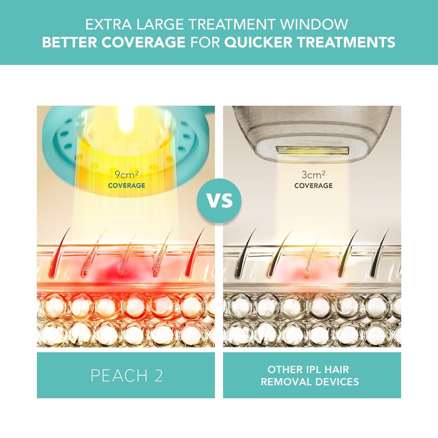 imageFOREO Peach 2 IPL Hair Removal Device Quick ampamp Gentle Hair Reduction for Full Body ampamp Face Skin Cooling System Silicone Shield Customizable