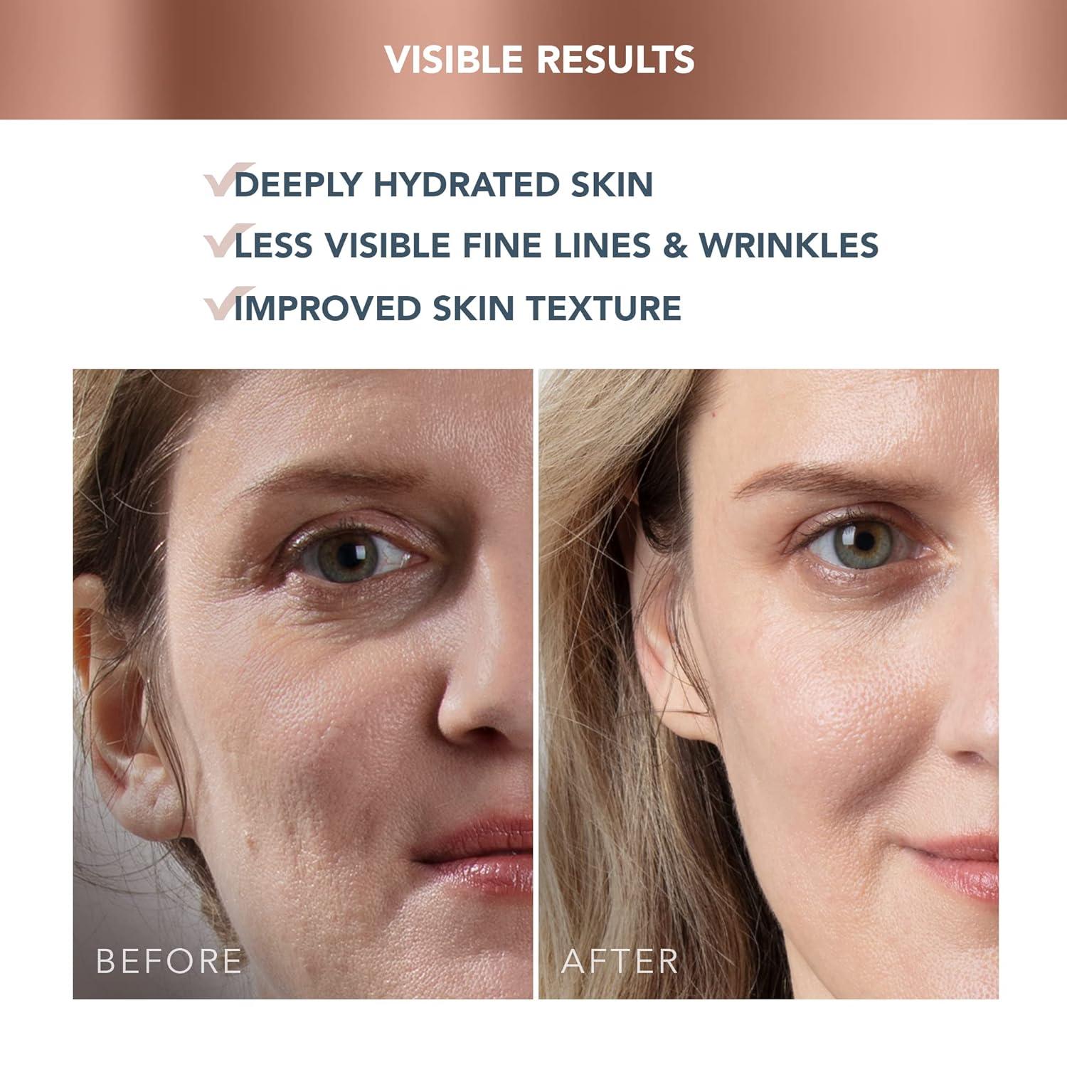 imageFOREO SUPERCHARGED HAPGA Face Moisturizer Wrinkle Cream for Face Hyaluronic Acid ampamp Squalane Vegan Cruelty ampamp Gluten Free Clean Skincare 16 floz16 Fl Oz